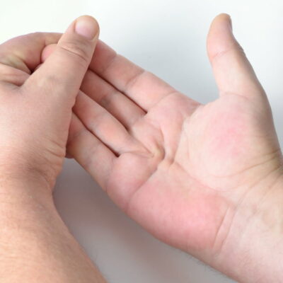 4 warning signs of Dupuytren’s contracture
