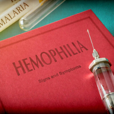 Hemophilia – Symptoms to look out for